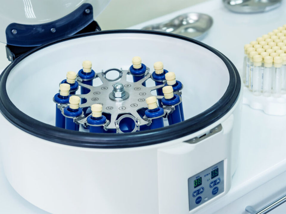 Why is my centrifuge imbalanced? Solving the imbalanced centrifuge problem